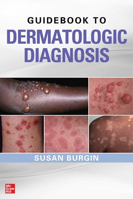 Guidebook to Dermatologic Diagnosis by Burgin, Susan