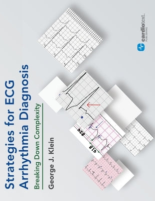 Strategies for ECG Arrhythmia Diagnosis: Breaking Down Complexity by Klein, George J.