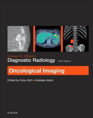 Grainger & Allison's Diagnostic Radiology: Oncological Imaging by Goh, Victoria