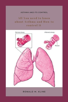 Asthma and its control: All you need to know about Asthma and how to control it. by Kline, Ronald M.