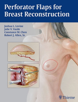 Perforator Flaps for Breast Reconstruction by Levine, Joshua L.