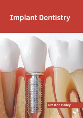 Implant Dentistry by Bailey, Preston