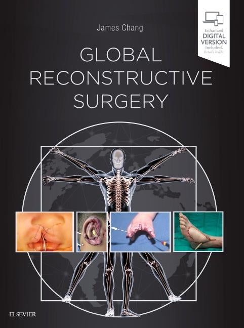 Global Reconstructive Surgery by Chang, James
