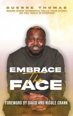 Embrace the Face: Scars Show Strength - Tells YourStory, as You Walk in Purpose: Scars Show Strength: Tells Your Story, as You Walk in Purpose by Thomas, Duerre