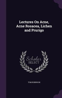 Lectures On Acne, Acne Rosacea, Lichen and Prurigo by Robinson, Tom