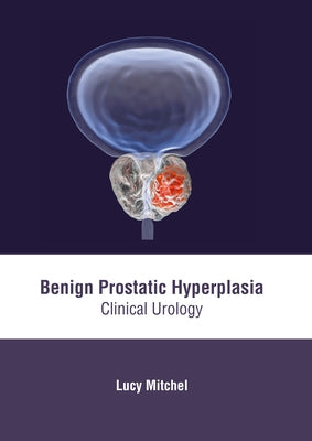 Benign Prostatic Hyperplasia: Clinical Urology by Mitchel, Lucy