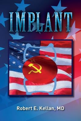 Implant by Kellan, MD Robert E.