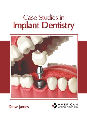 Case Studies in Implant Dentistry by James, Drew