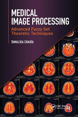 Medical Image Processing: Advanced Fuzzy Set Theoretic Techniques by Chaira, Tamalika
