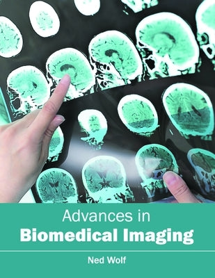Advances in Biomedical Imaging by Wolf, Ned