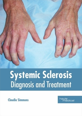 Systemic Sclerosis: Diagnosis and Treatment by Simmons, Claudia
