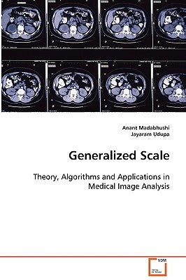 Generalized Scale by Madabhushi, Anant