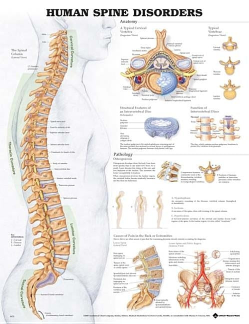Human Spine Disorders Anatomical Chart by Anatomical Chart Company