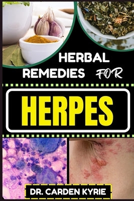 Herbal Remedies for Herpes: Unlocking Nature's Healing Power For Targeting Relief, Holistic Wellness, Immune Support And Integrating Herbs Into Yo by Kyrie, Carden