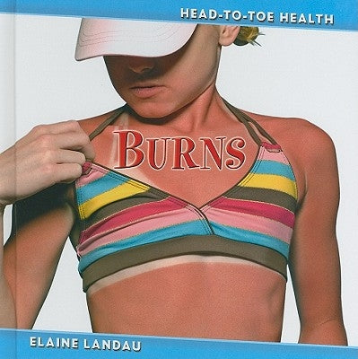 Burns by Landau, Elaine