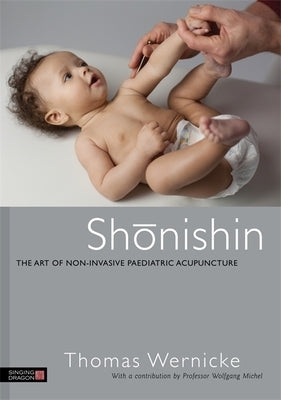 Shonishin: The Art of Non-Invasive Paediatric Acupuncture by Oppenheimer, Anne