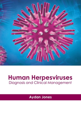 Human Herpesviruses: Diagnosis and Clinical Management by Jones, Aydan