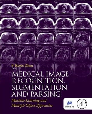Medical Image Recognition, Segmentation and Parsing: Machine Learning and Multiple Object Approaches by Zhou, S. Kevin