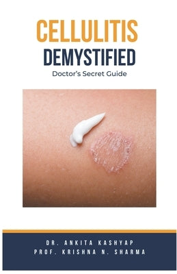 Cellulitis Demystified: Doctor's Secret Guide by Kashyap, Ankita