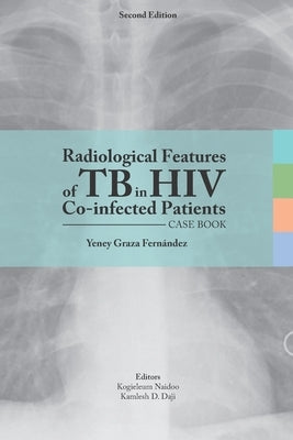 Radiological features of TB in HIV Co-infected Patients. Case book by Naidoo, Kogieleum