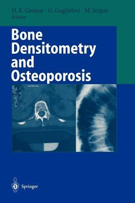 Bone Densitometry and Osteoporosis by Genant, Harry K.