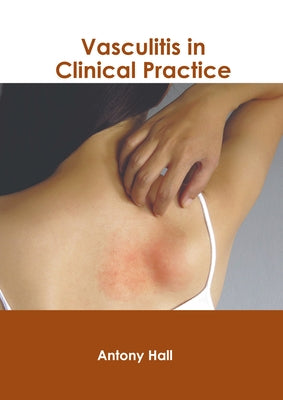 Vasculitis in Clinical Practice by Hall, Antony