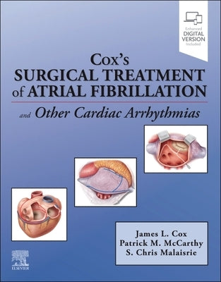 Cox's Surgical Treatment of Atrial Fibrillation by Cox, James