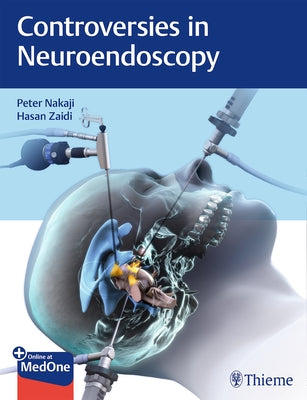 Controversies in Neuroendoscopy by Nakaji, Peter