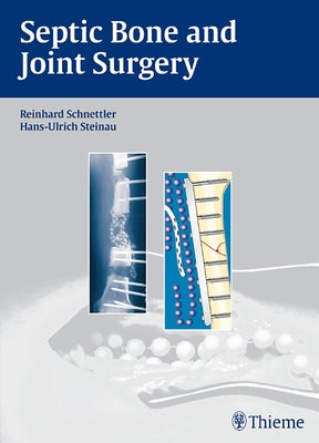 Septic Bone and Joint Surgery by Schnettler, Reinhard