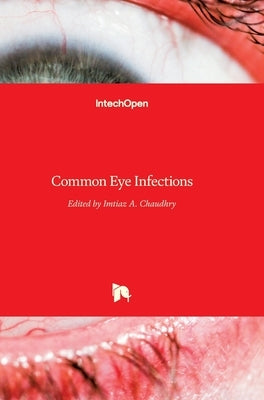Common Eye Infections by Chaudhry, Imtiaz