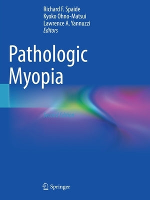 Pathologic Myopia by Spaide, Richard F.