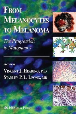 From Melanocytes to Melanoma: The Progression to Malignancy by Hearing, Vincent J.