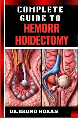 Complete Guide to Hemorrhoidectomy: Comprehensive Handbook To Surgical Treatment, Recovery, Pain Management, And Post Operative Care by Horan, Bruno
