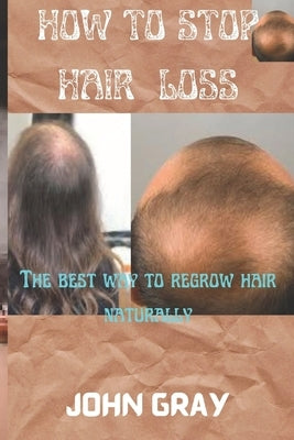 How to stop hair loss: The best way to regrow hair naturally by Gray, John