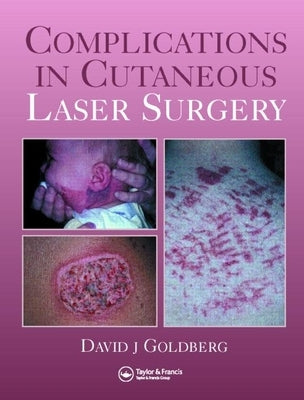 Complications in Laser Cutaneous Surgery by Goldberg, David J.