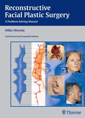Reconstructive Facial Plastic Surgery: A Problem-Solving Manual by Weerda, Hilko