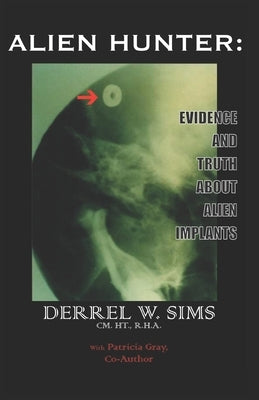 Alien Implants: Evidence & Truth about Alien Implants by Sims, Derrel W.