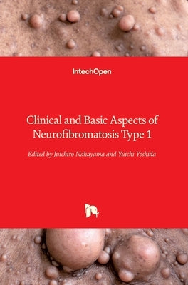Clinical and Basic Aspects of Neurofibromatosis Type 1 by Nakayama, Juichiro