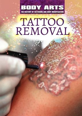 Tattoo Removal by Faulkner, Nicholas