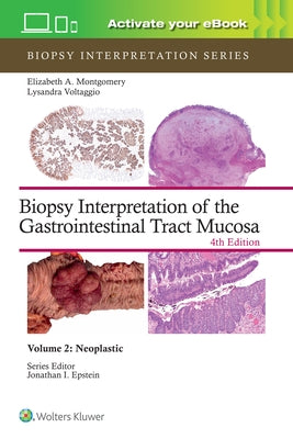 Biopsy Interpretation of the Gastrointestinal Tract Mucosa Volume 2: Neoplastic: Print + eBook with Multimedia Volume 2 by Montgomery, Elizabeth Anne