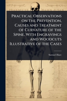 Practical Observations on the Prevention, Causes and Treatment of Curvature of the Spine, With Engravings and Woodcuts Illustrative of the Cases by Hare, Samuel