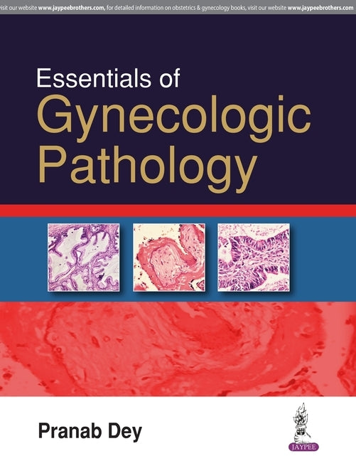 Essentials of Gynecologic Pathology by Dey, Pranab