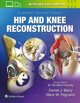 Illustrated Tips and Tricks in Hip and Knee Reconstructive and Replacement Surgery by Berry, Daniel J.