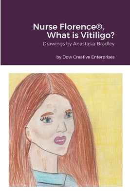 Nurse Florence(R), What is Vitiligo? by Dow, Michael