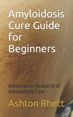 Amyloidosis Cure Guide for Beginners: Advances in Research of Amyloidosis Cure by Rhett, Ashton
