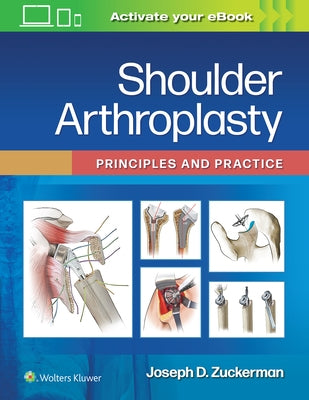 Shoulder Arthroplasty: Principles and Practice by Zuckerman, Joseph D.
