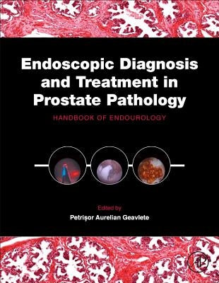 Endoscopic Diagnosis and Treatment in Prostate Pathology: Handbook of Endourology by Geavlete, Petrisor Aurelian