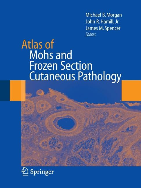 Atlas of Mohs and Frozen Section Cutaneous Pathology by Morgan, Michael