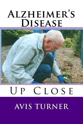 Alzheimer's Disease Up Close by Turner, Avis