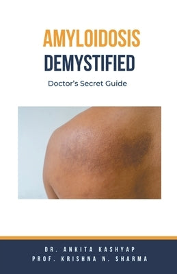 Amyloidosis Demystified: Doctor's Secret Guide by Kashyap, Ankita